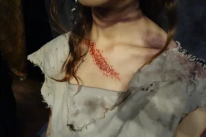 「怪我」が多い人に隠された意味とは？怪我をしたときのスピチュアルメッセージ